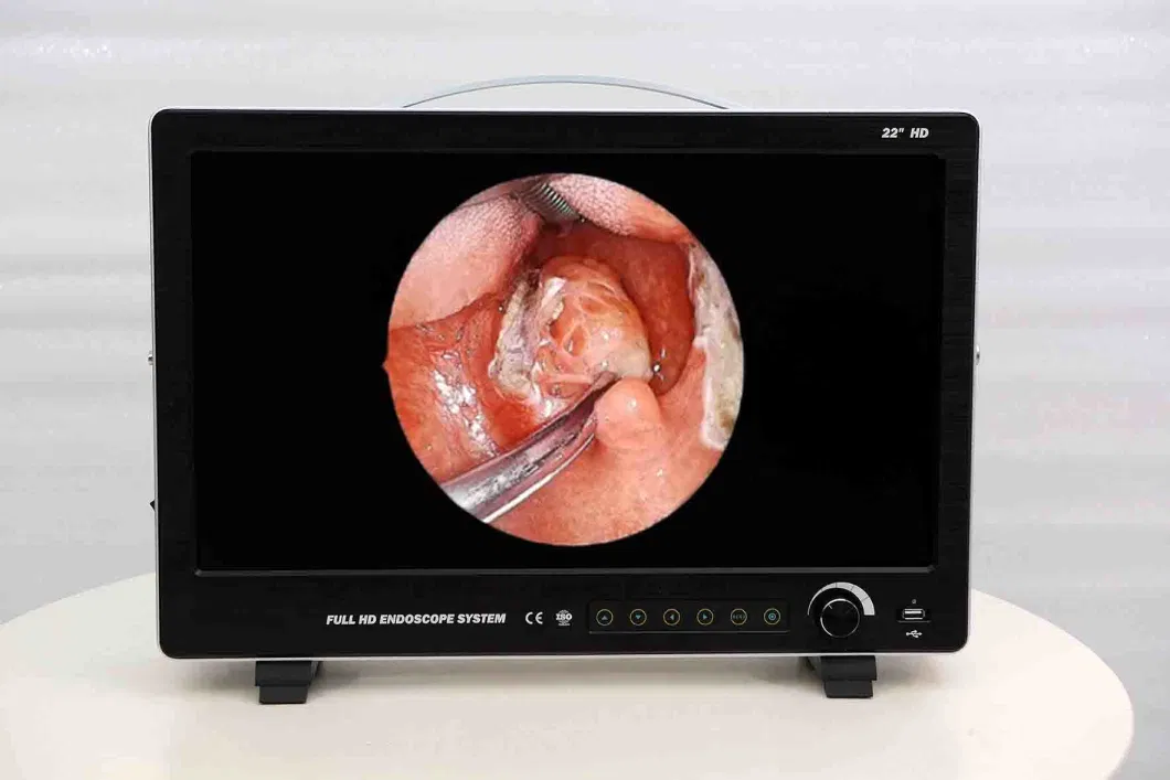 Ltes52 Portable Surgical Endoscopy Camera Medical Endoscope System with Cold Light Source